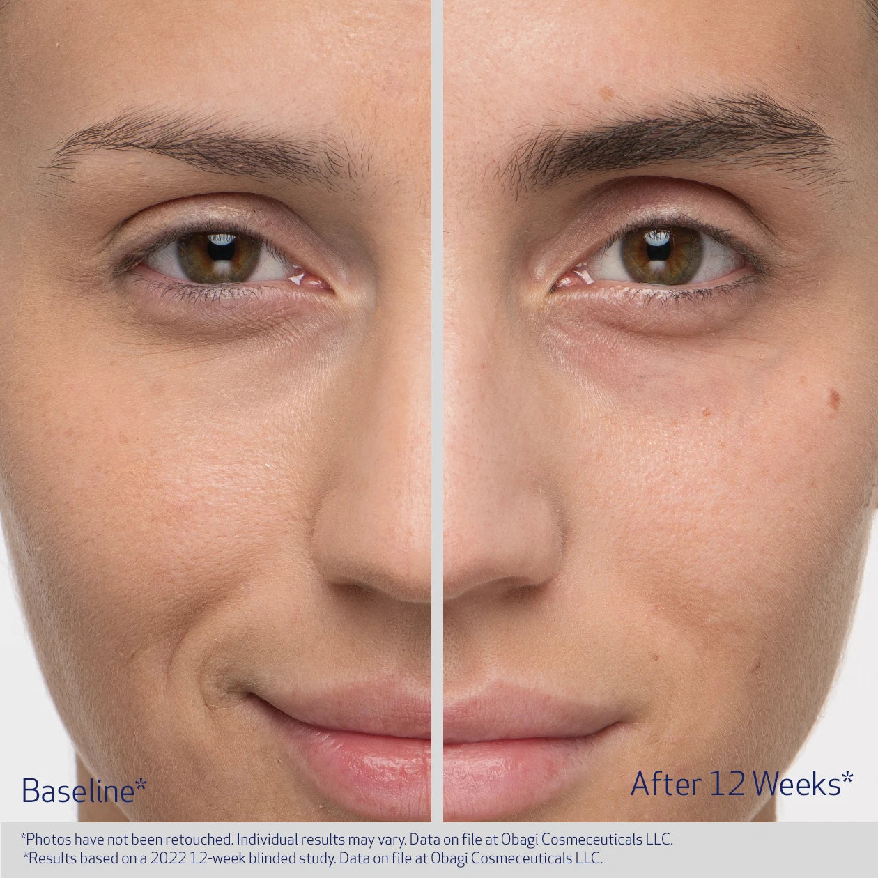 Obagi NU-CIL® Eyebrow Boosting Serum