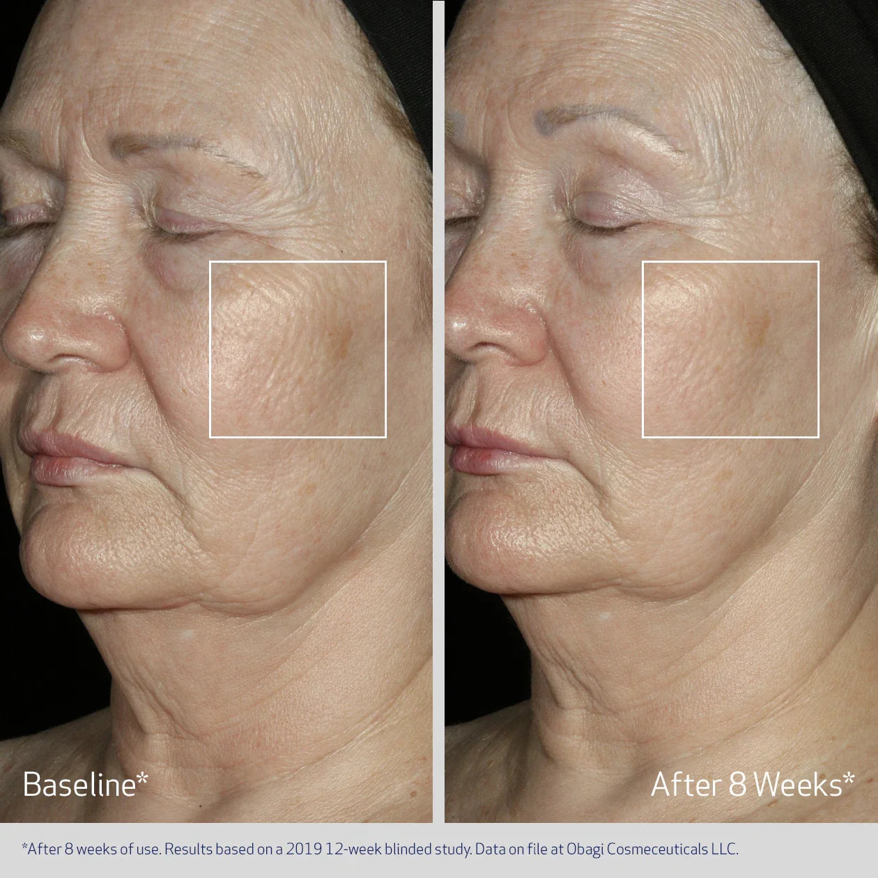 Obagi ELASTIDERM® Facial Serum