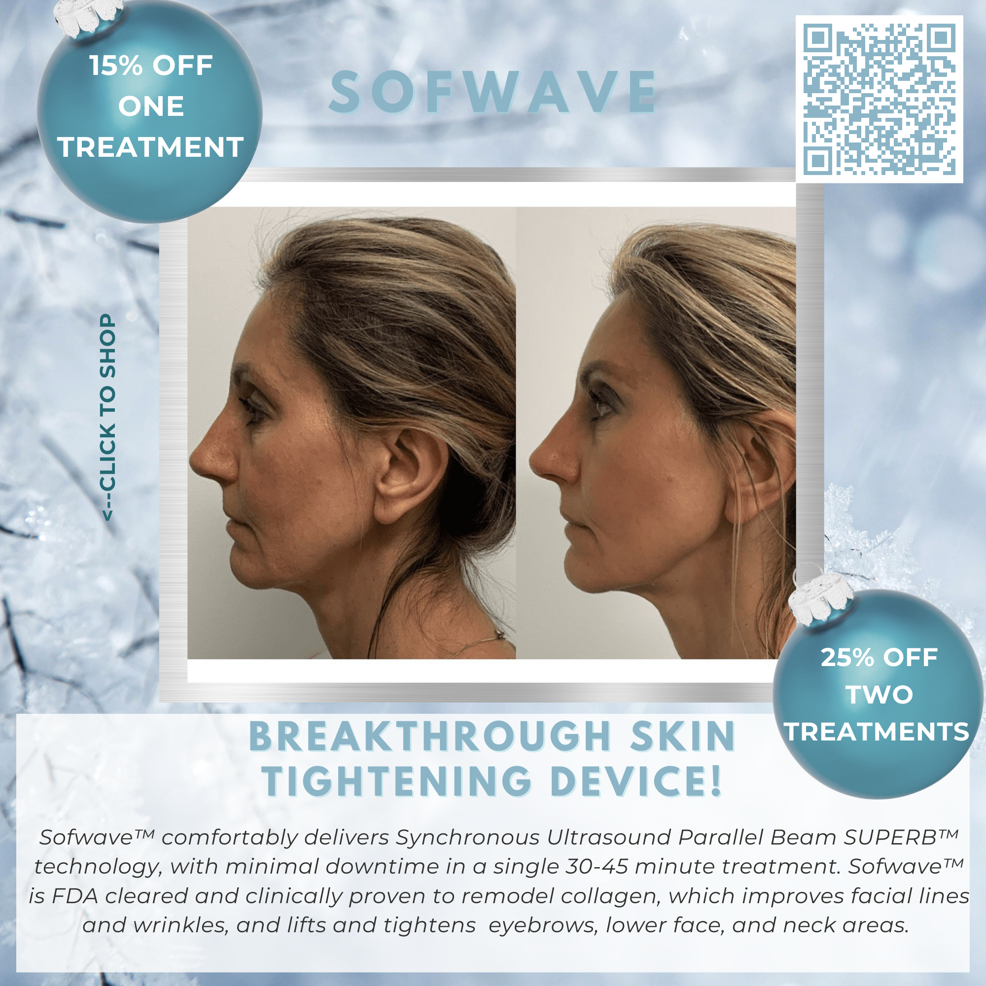 Wish Book - Sofwave Laser Skin Resurfacing