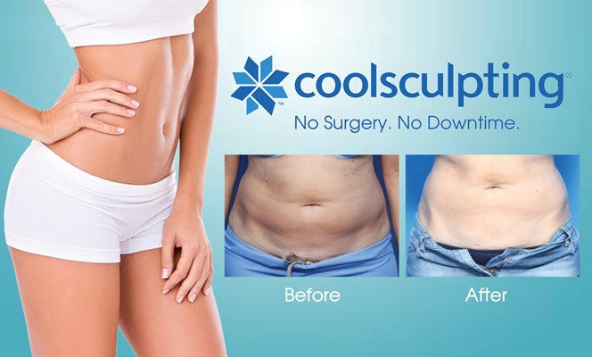 Open House - Coolsculpting
