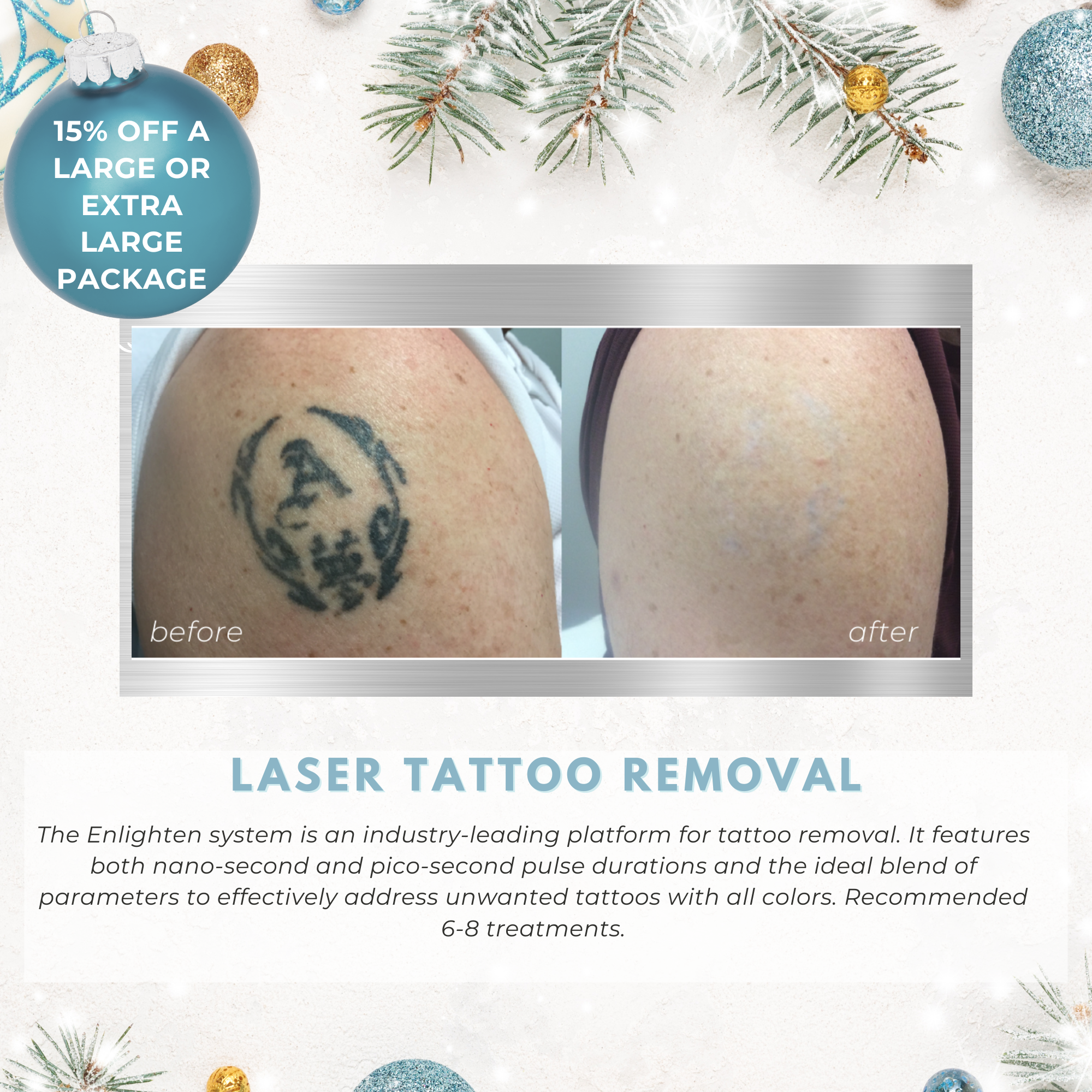Wish Book - Laser Tattoo Removal