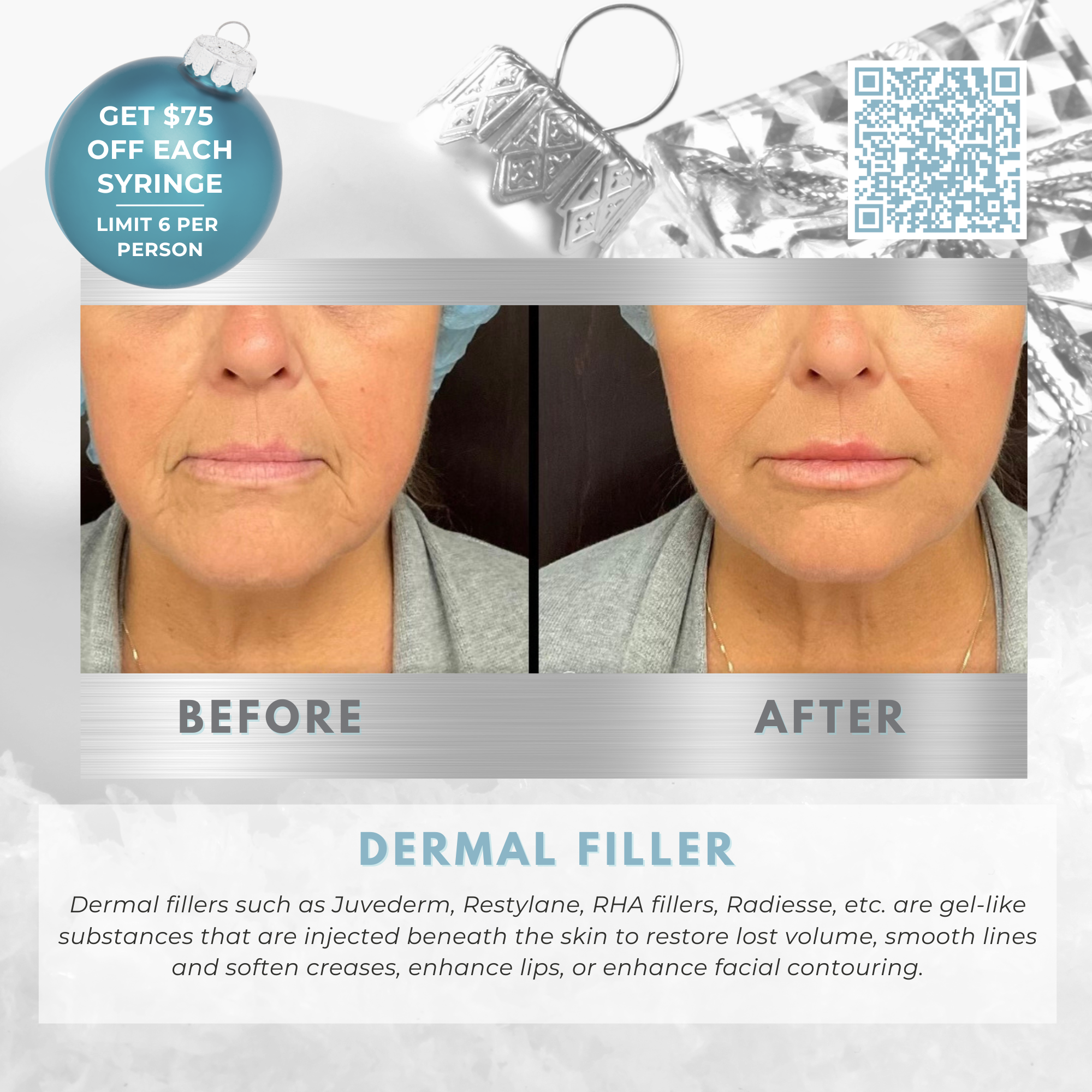 Wish Book - Dermal Filler