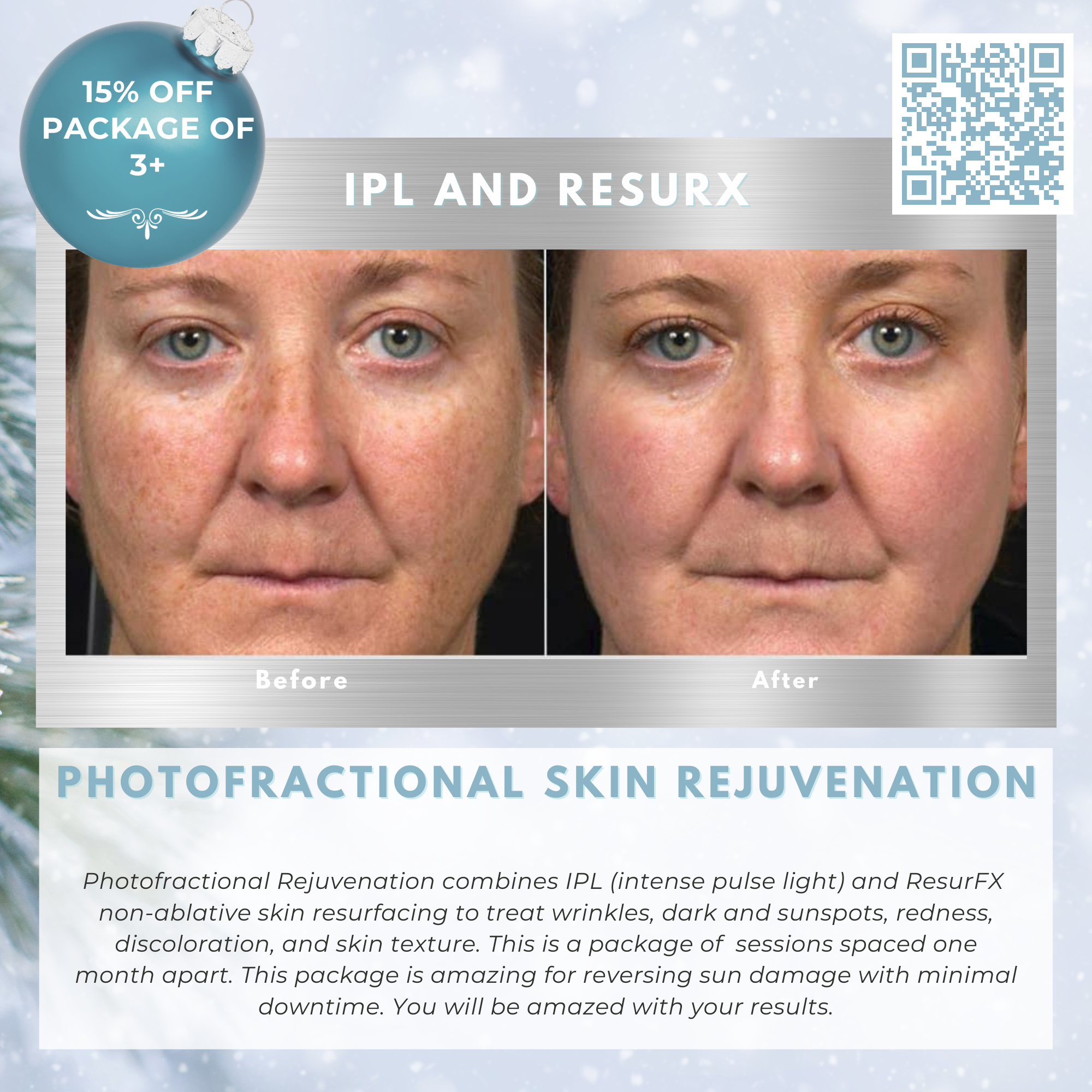 Wish Book - Photofractional Skin Rejuvenation