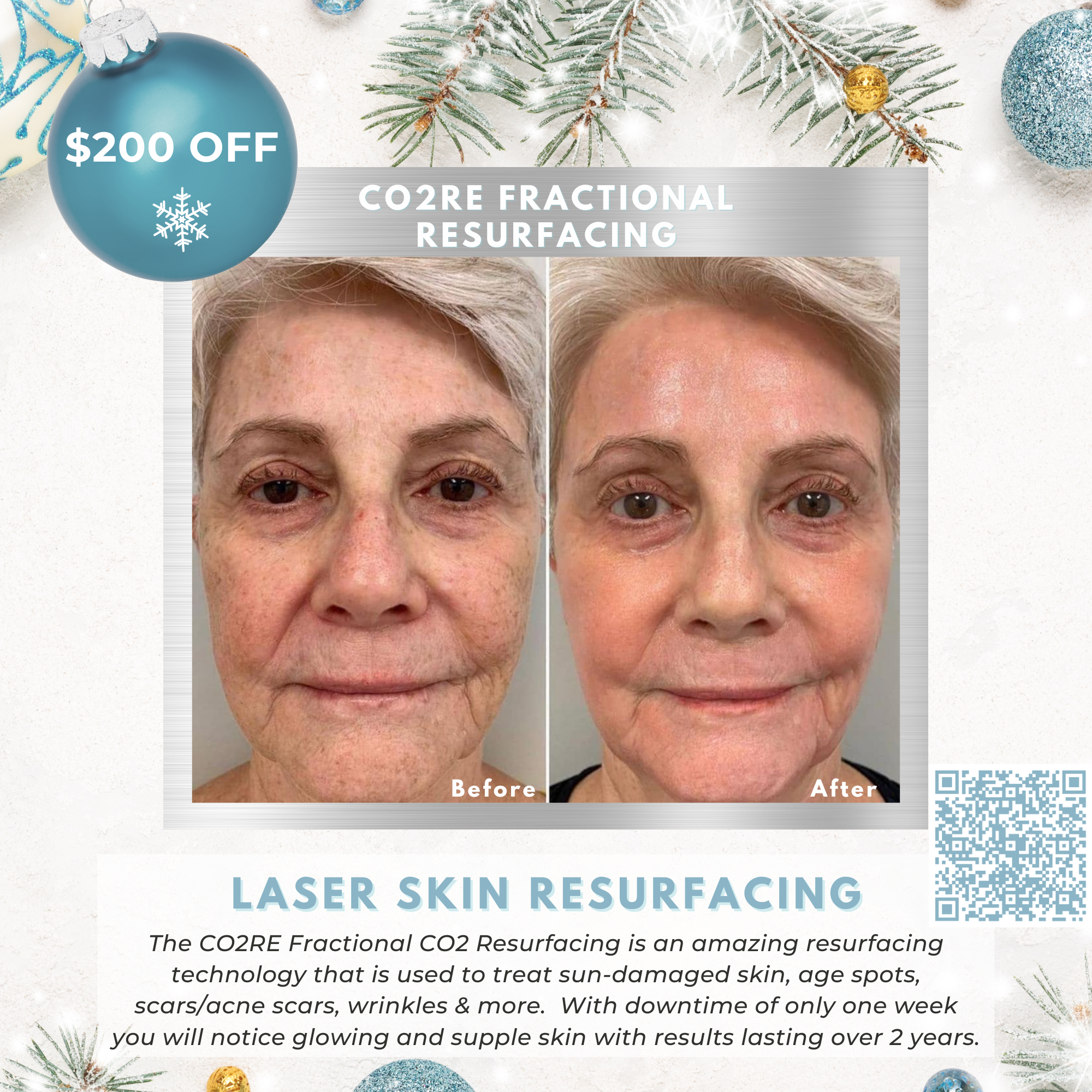 Wish Book - CO2RE Laser Skin Resurfacing