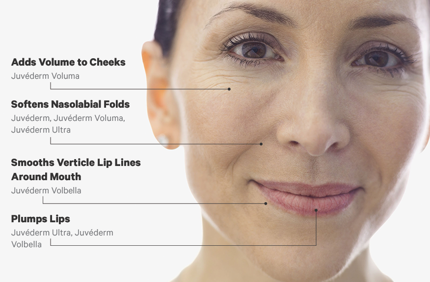 Open House - JUVÉDERM SkinVive