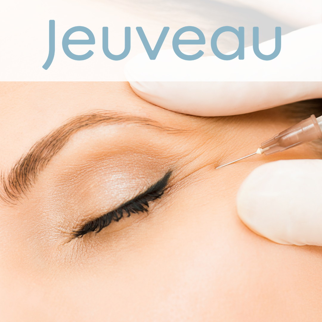 Jeuveau