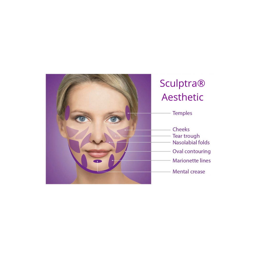 Open House - Sculptra