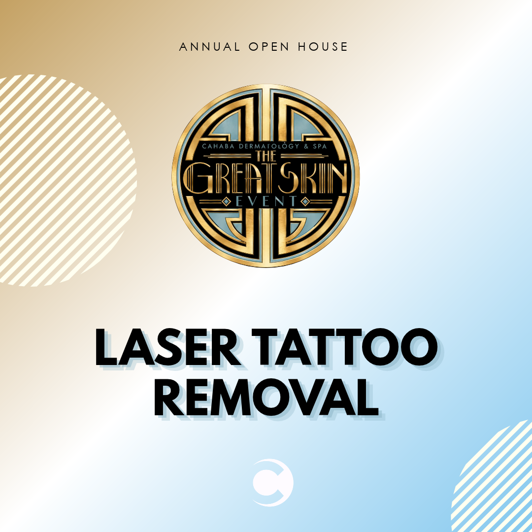 Open House - Laser Tattoo Removal