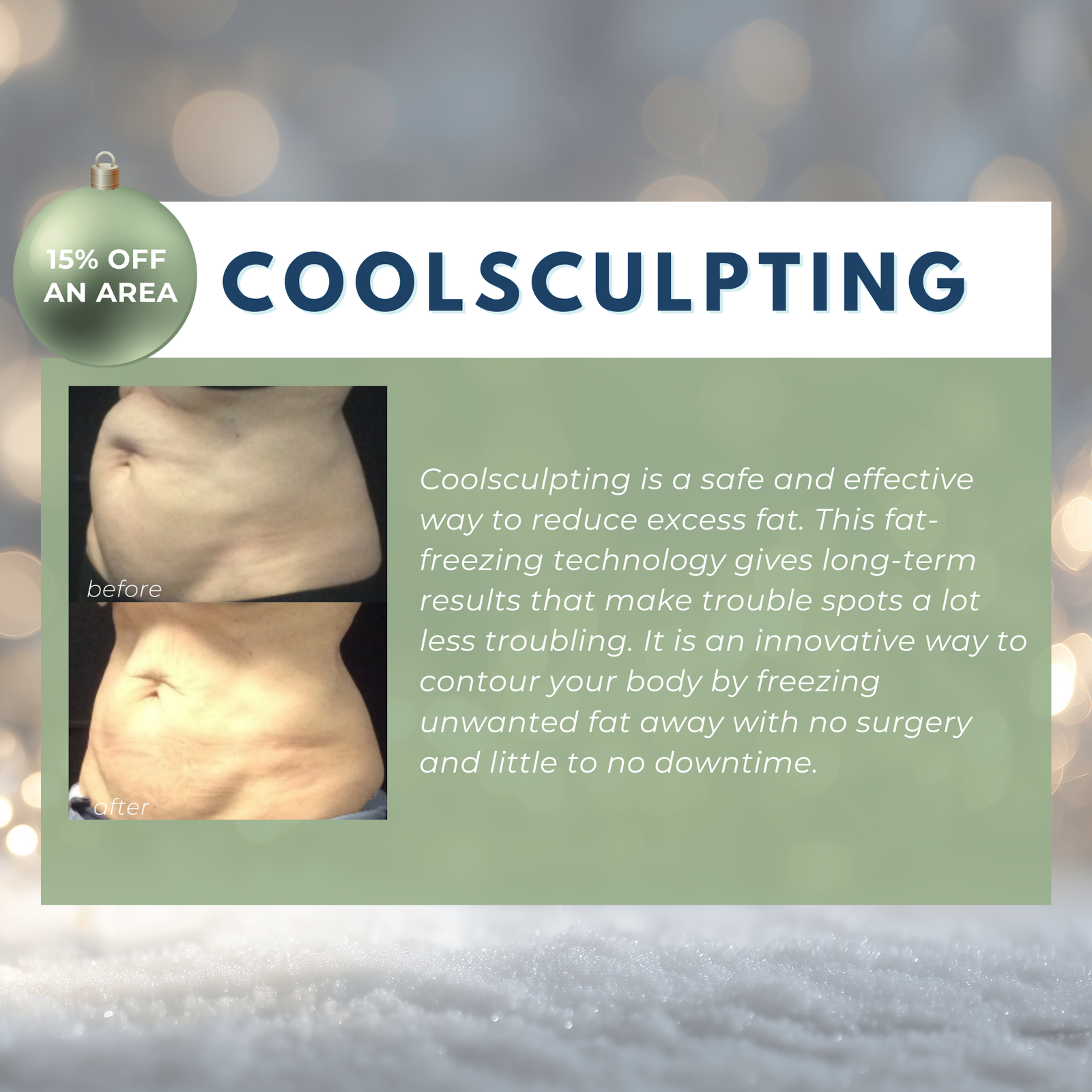 Wish Book - Coolsculpting