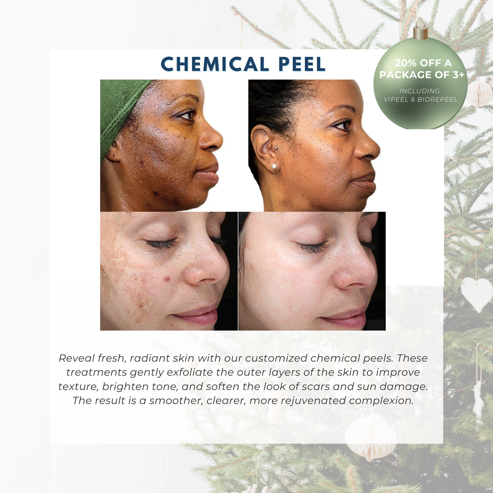 Wish Book - Chemical Peel (In-Office Treatment Only)