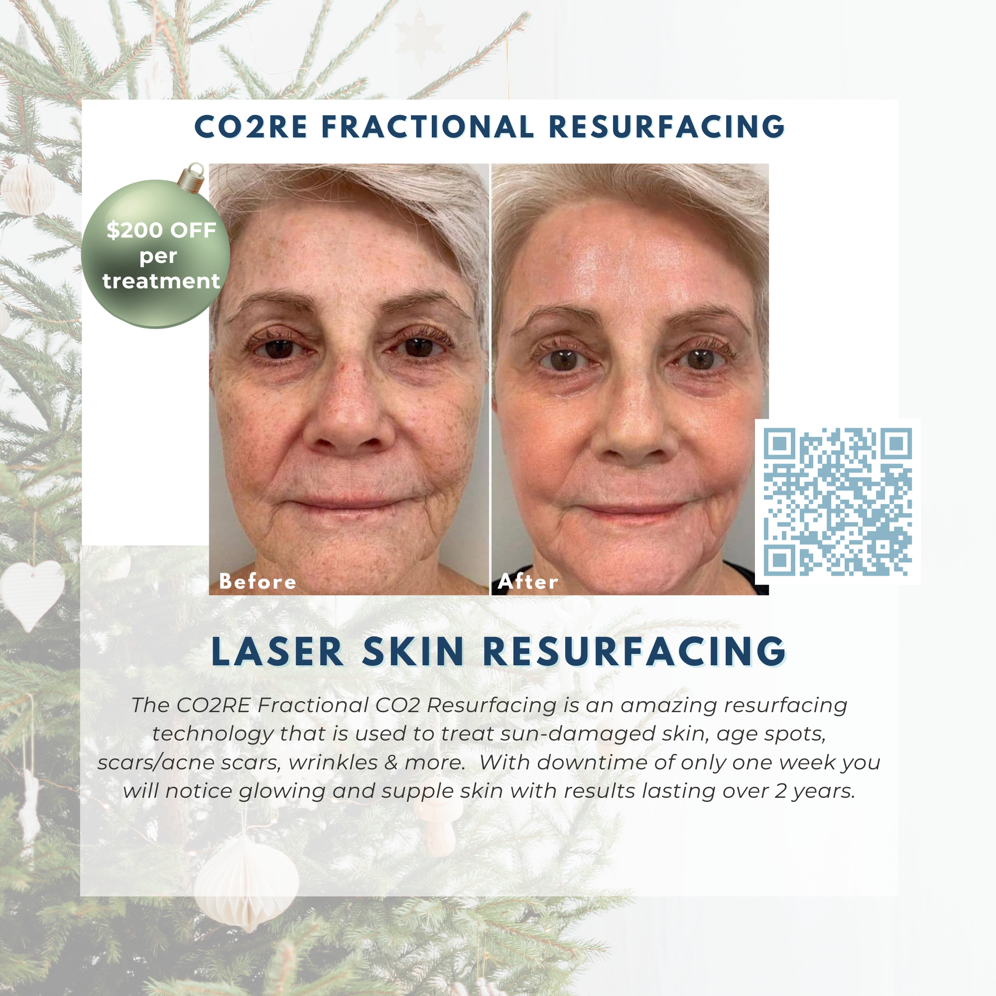 Wish Book - CO2RE Laser Skin Resurfacing