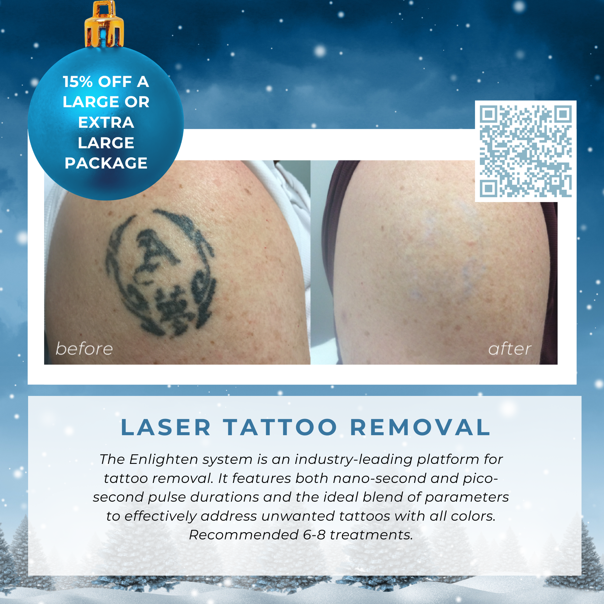 Wish Book - Laser Tattoo Removal