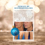 Wish Book - Genius RF Microneedling