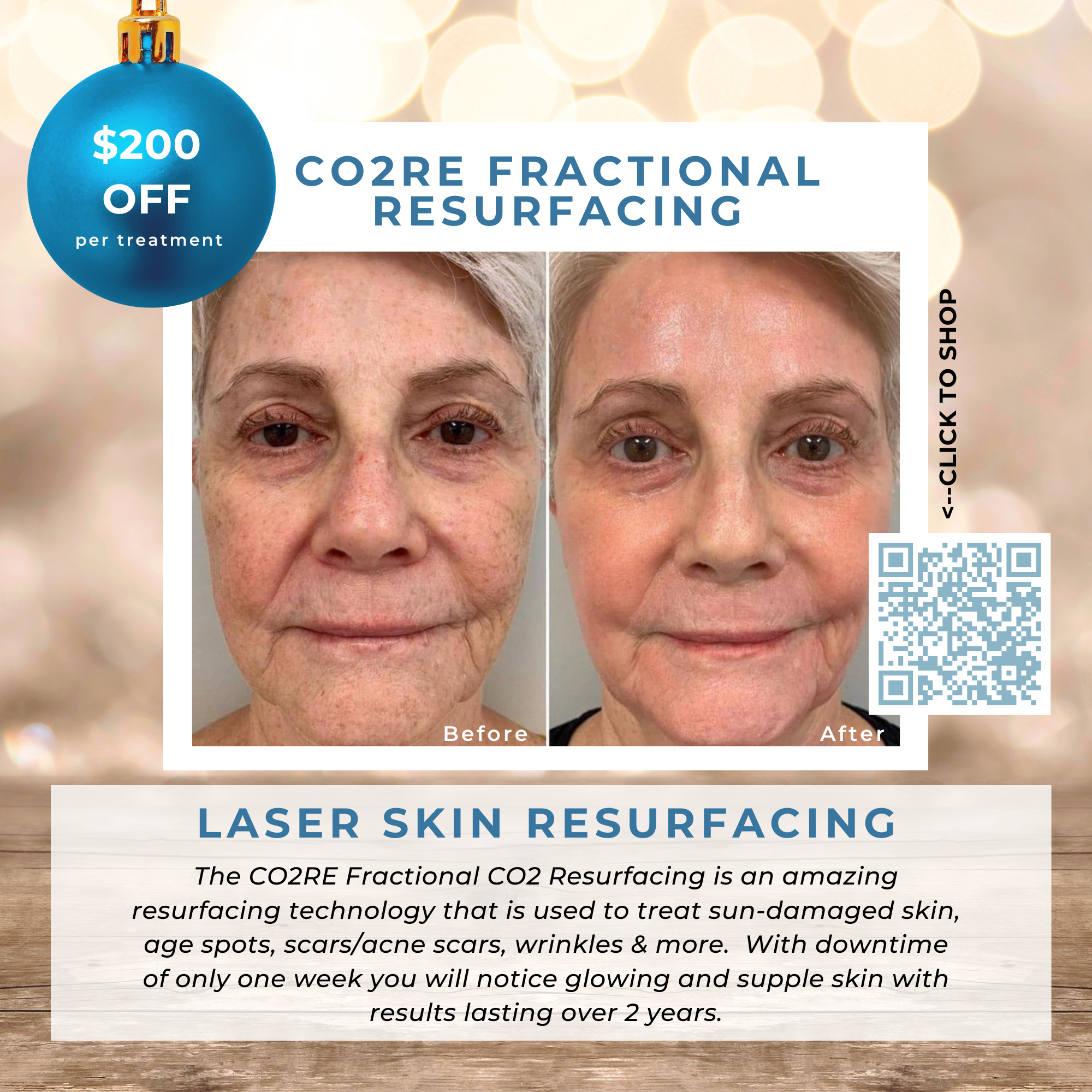 Wish Book - CO2RE Laser Skin Resurfacing