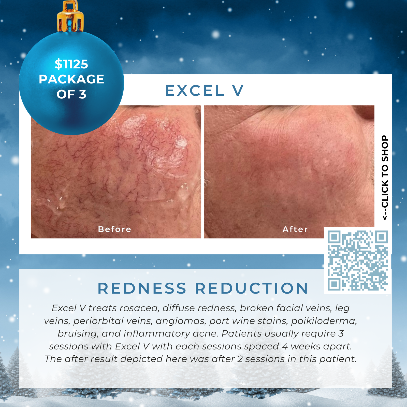 Wish Book - Excel V Redness Reduction