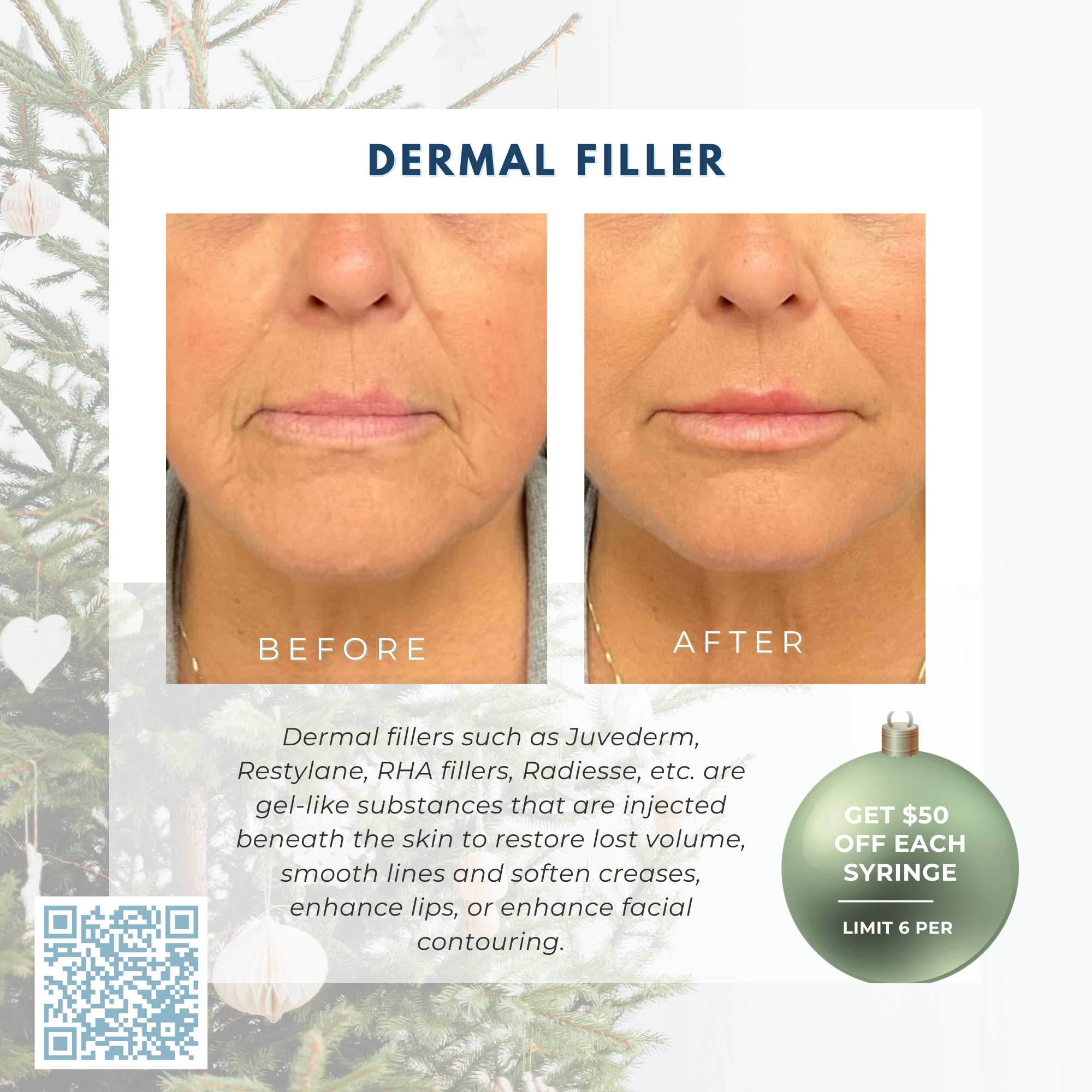 Wish Book - Dermal Filler
