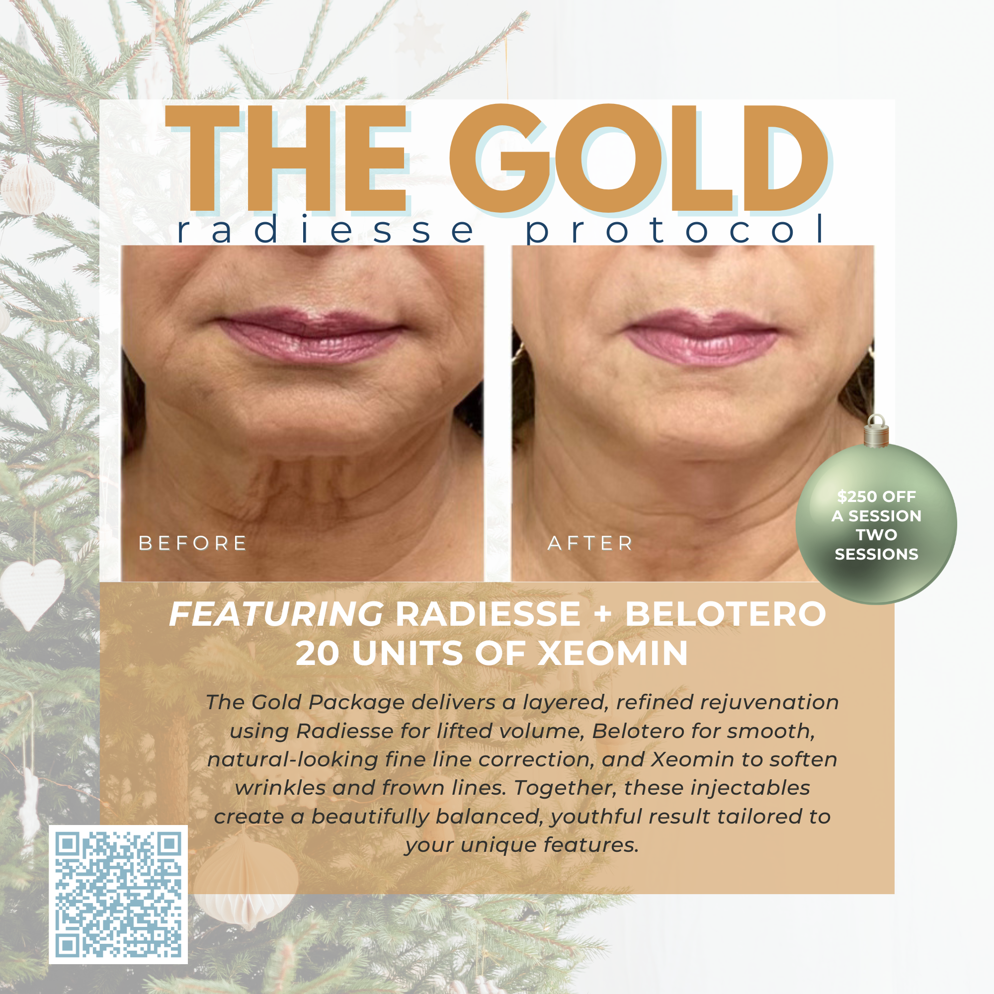 Wish Book - Radiesse Gold Protocol