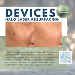 Wish Book - HALO® Laser by Sciton