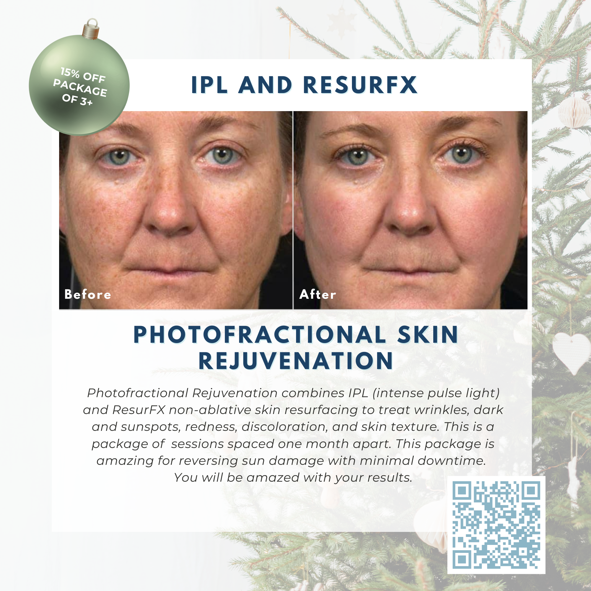 Wish Book - Photofractional Skin Rejuvenation