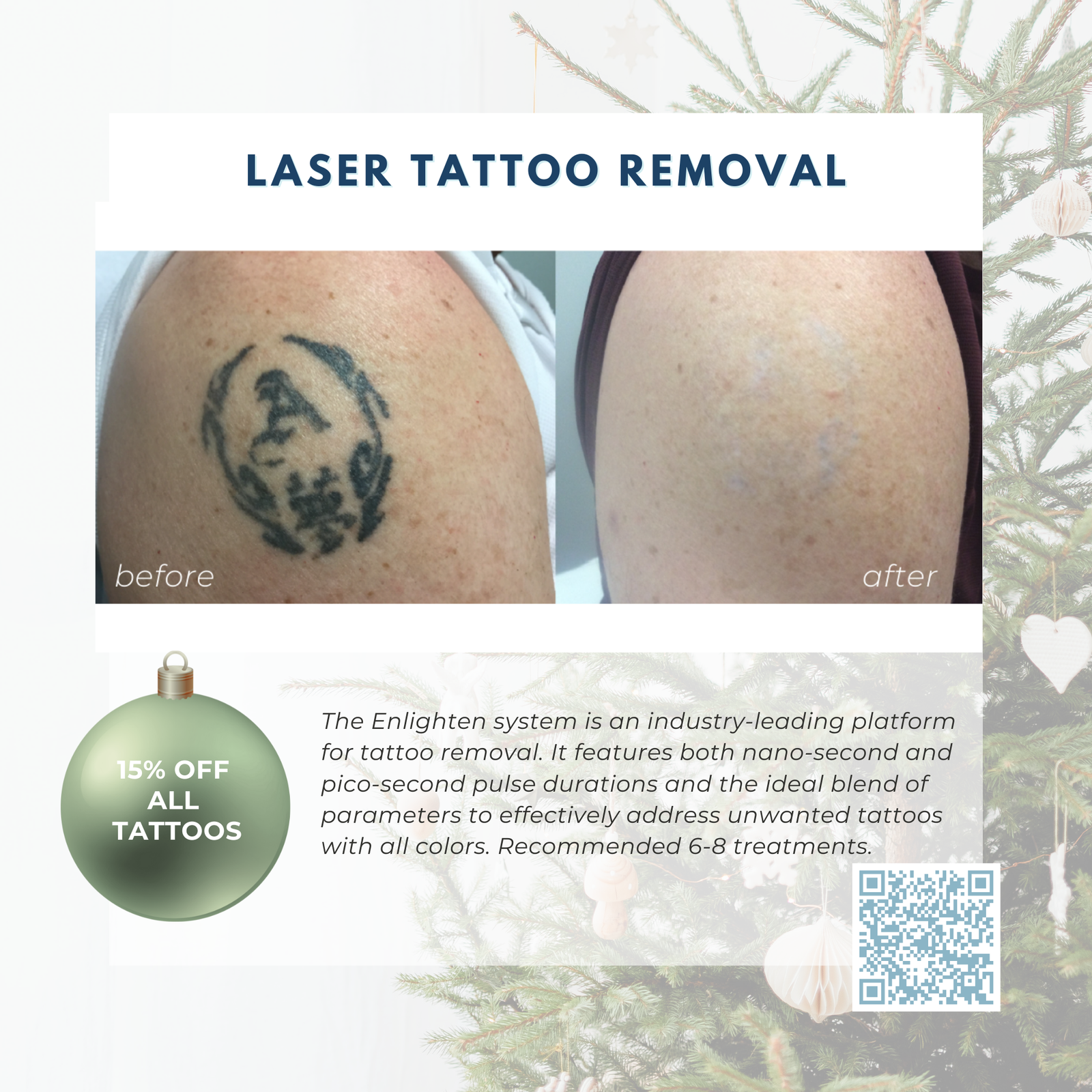 Wish Book - Laser Tattoo Removal