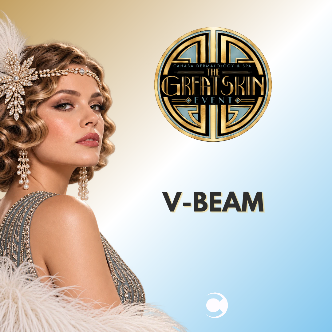 Open House - VBeam
