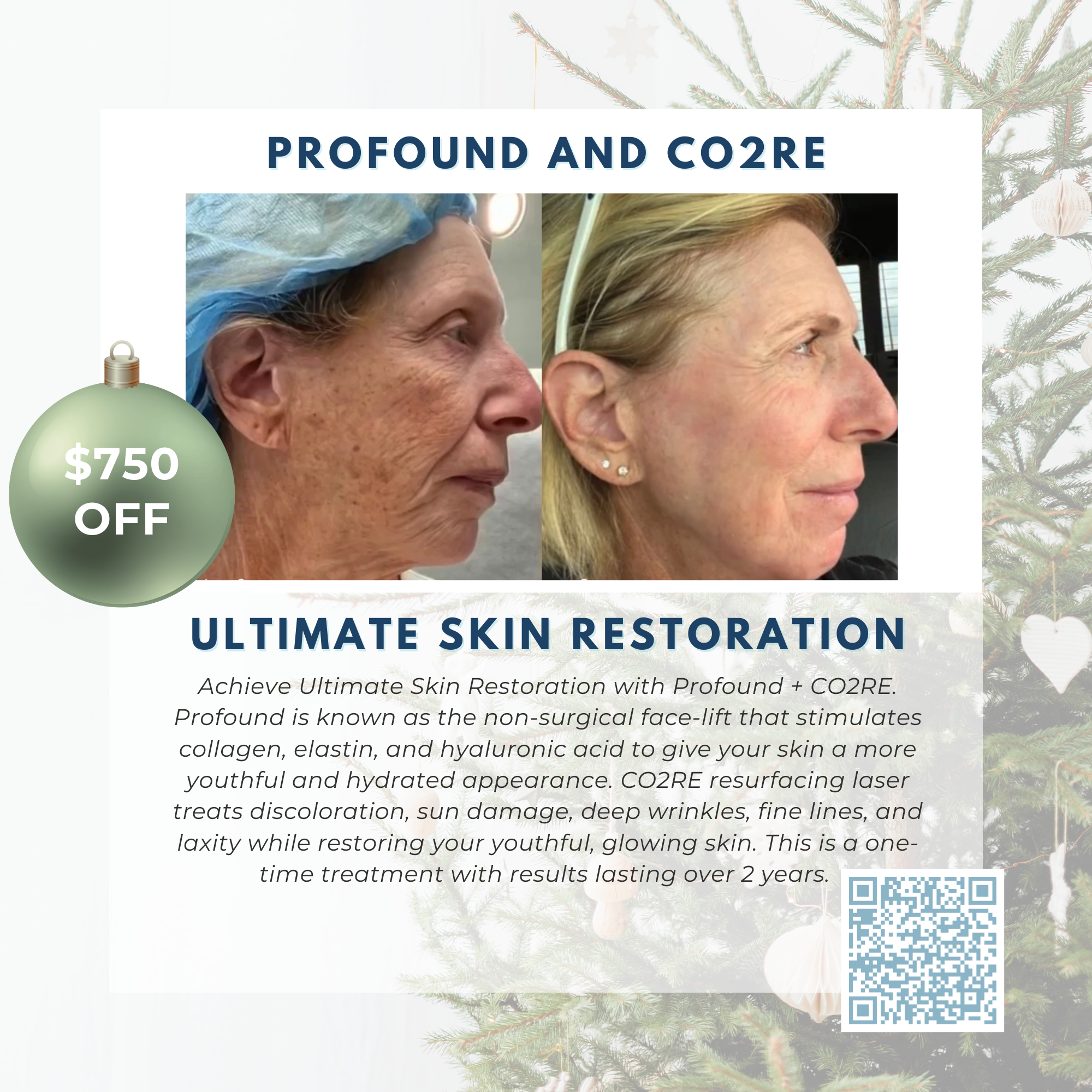 Wish Book - Ultimate Skin Restoration - Profound + CO2RE