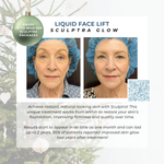 Wish Book - Sculptra