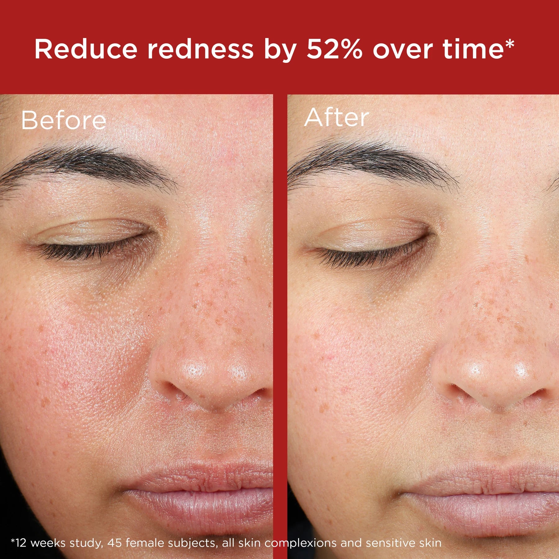 EltaMD UV Skin Recovery Red Color Correcting Green Tint Broad Spectrum SPF 50