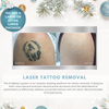 Wish Book - Laser Tattoo Removal