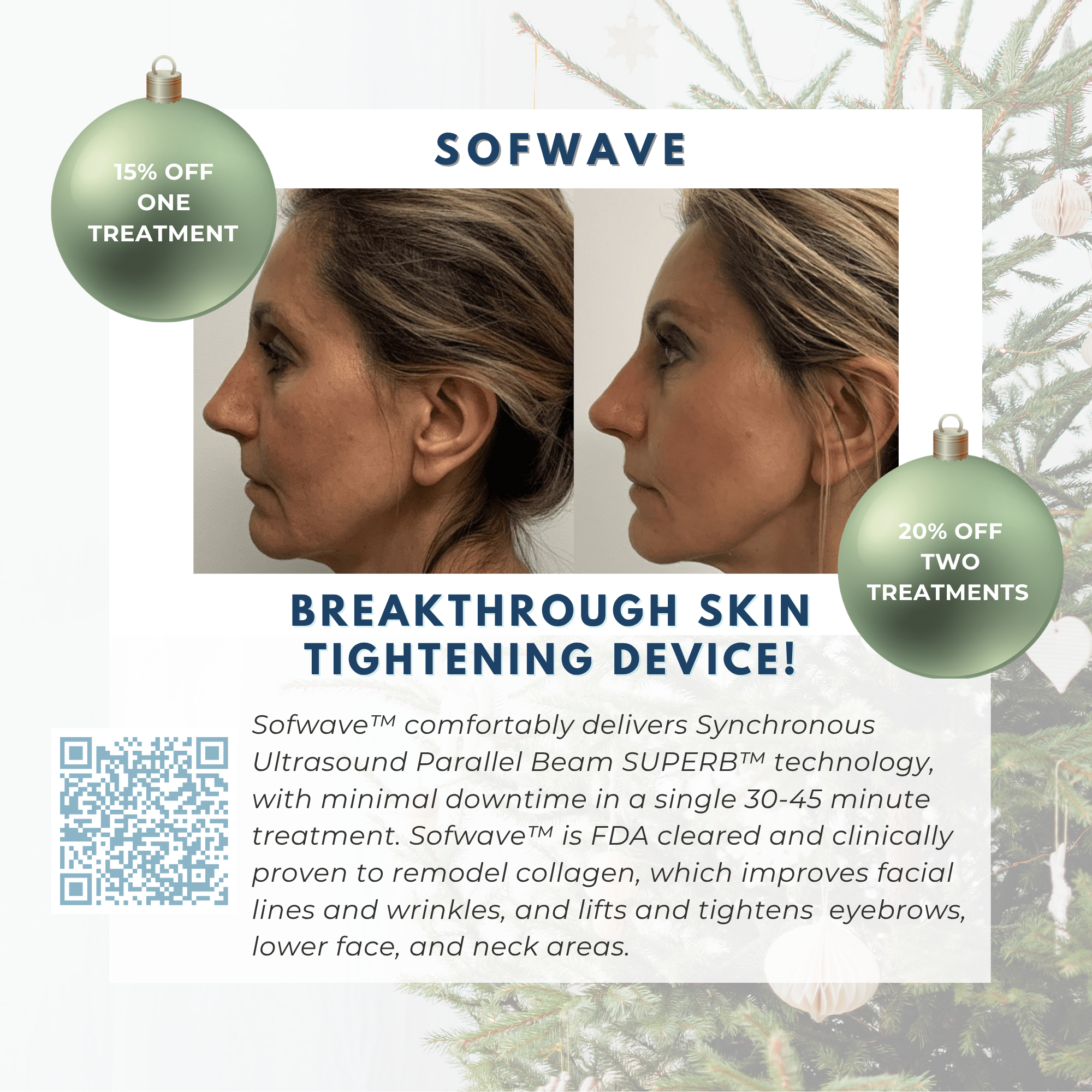 Wish Book - Sofwave Laser Skin Resurfacing