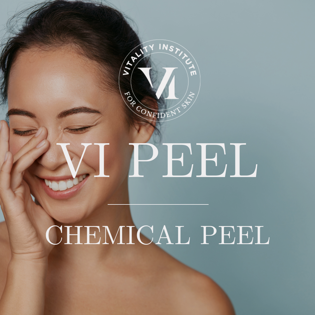 VI Chemical Peel Treatment