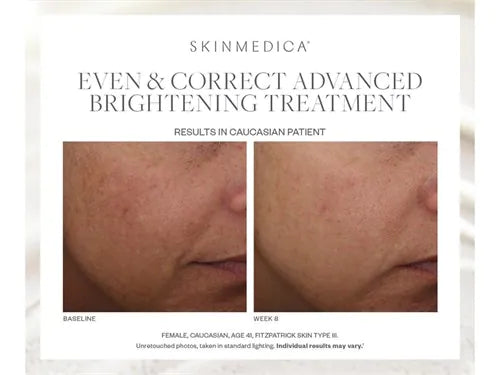 SkinMedica Even & Correct Advanced Brightening Serum