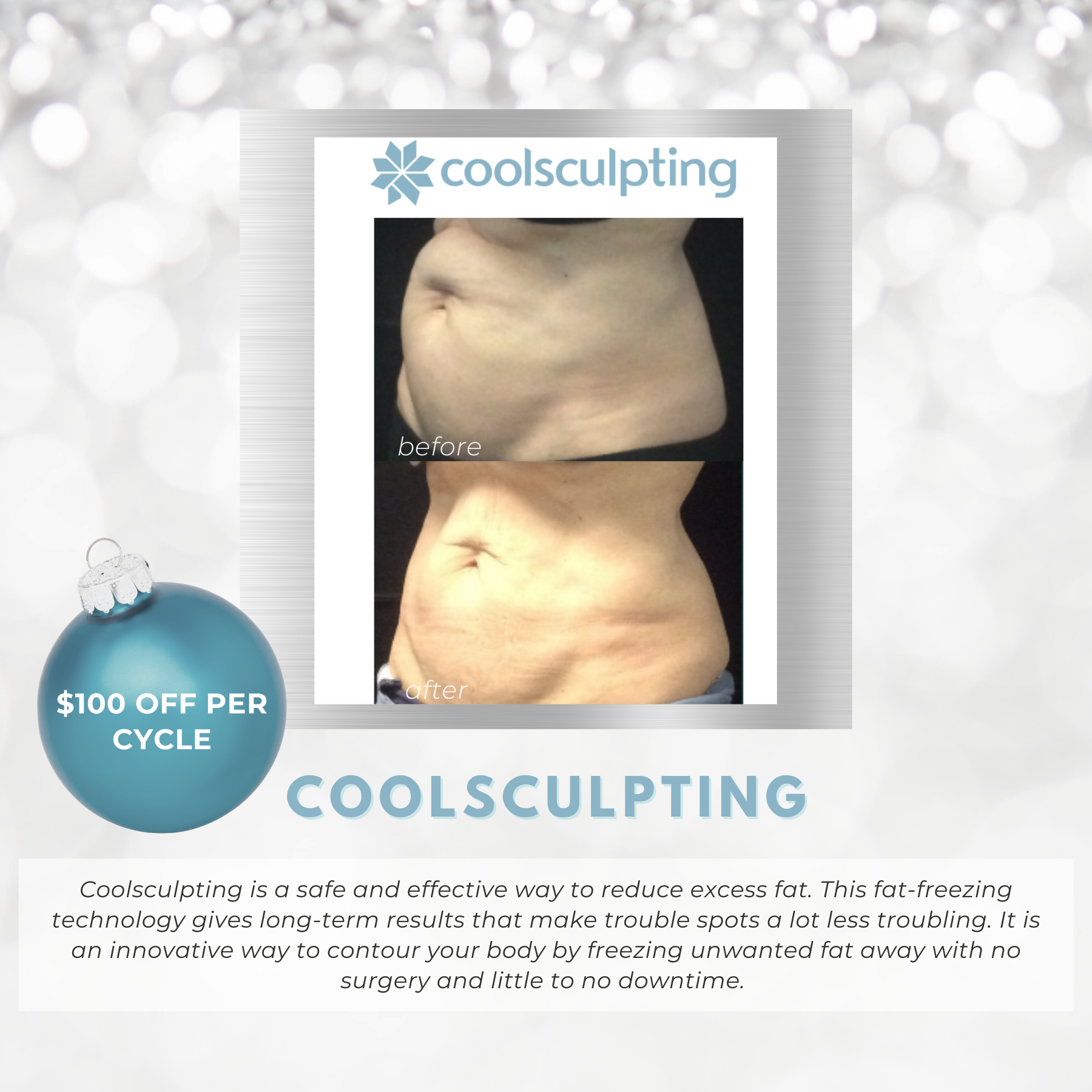 Wish Book - Coolsculpting