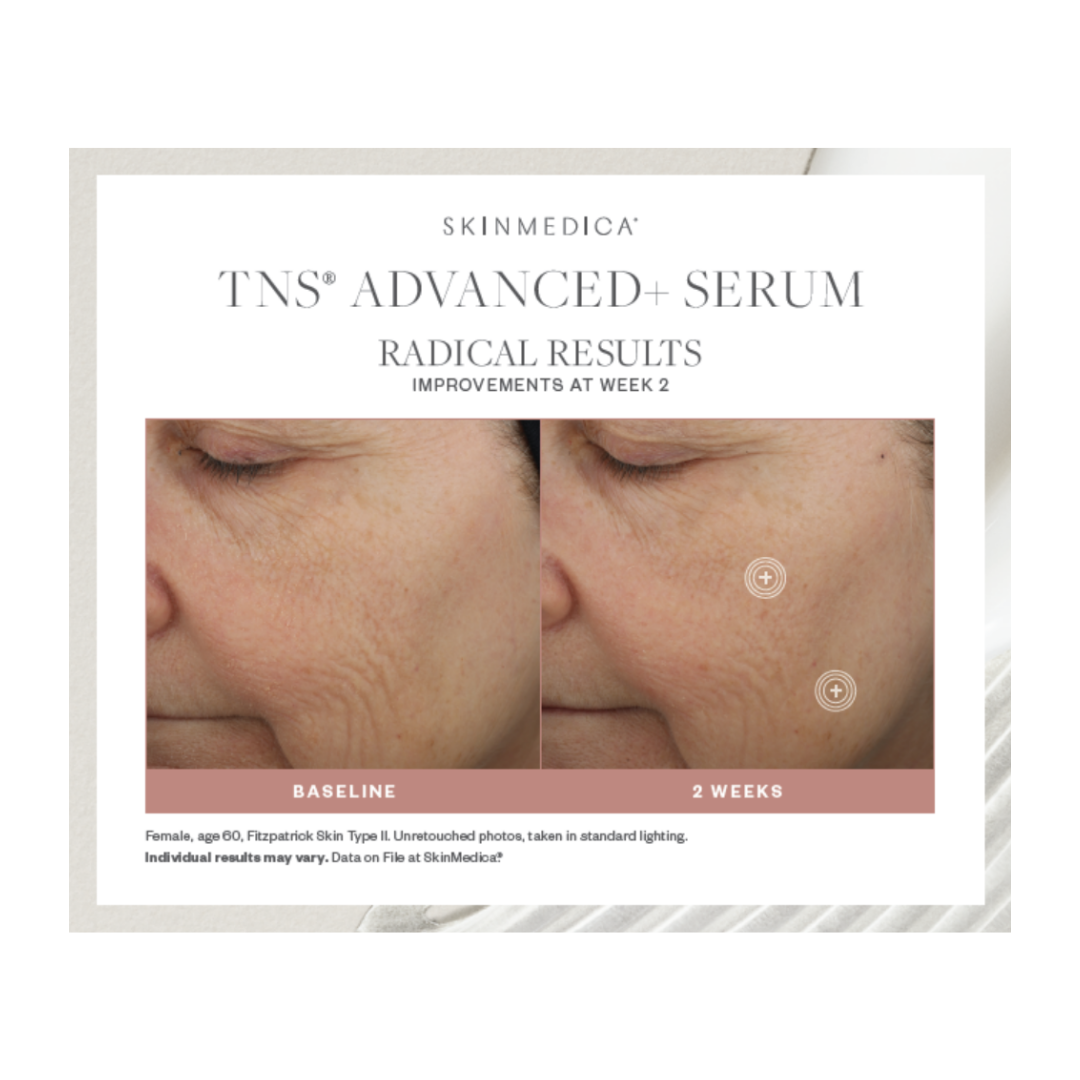 SkinMedica TNS® Advanced+ Serum