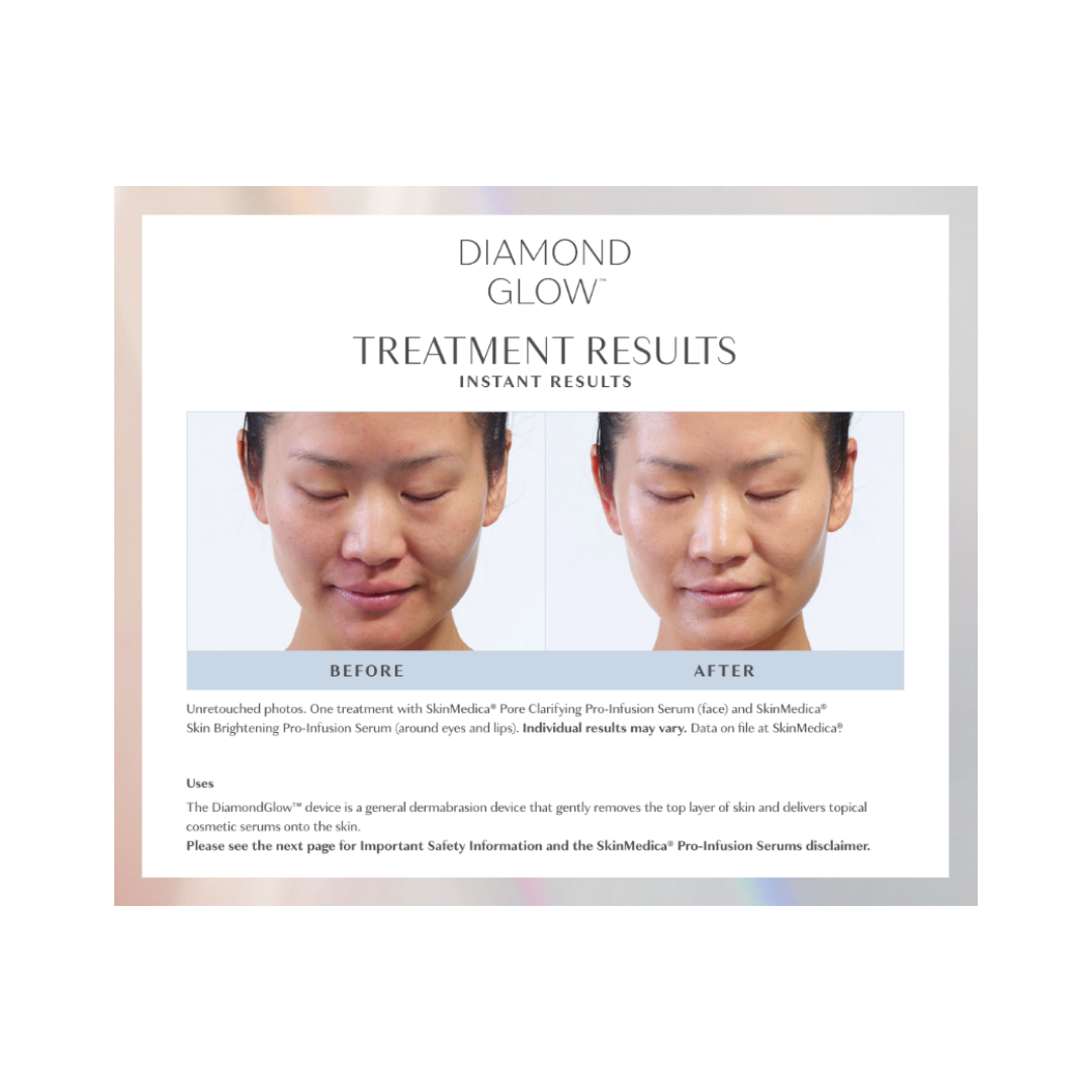 Open House - Diamond Glow® Facial