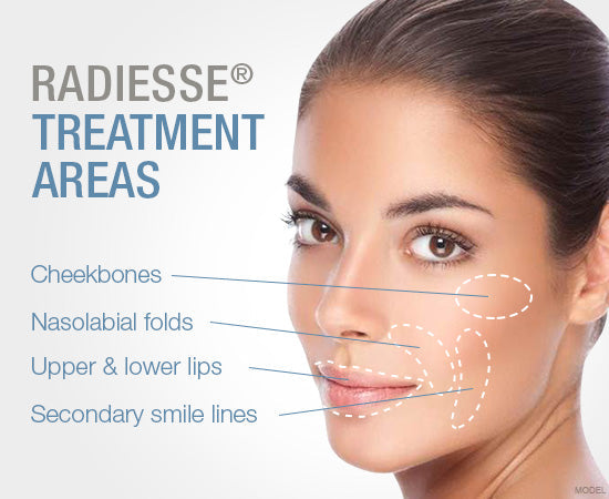 Open House - Radiesse Hyperdilute